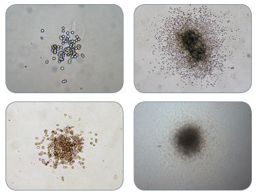 Examples of Colonies Derived From CFU-GM