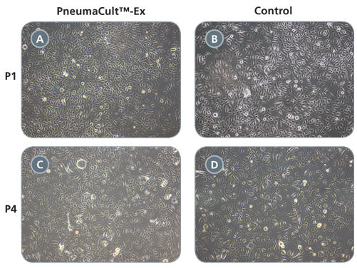 HBECs Cultured in PneumaCult™-Ex Exhibit Cobblestone Morphology