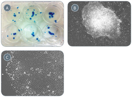 Generation of iPS Cells From 1mL of Peripheral Blood