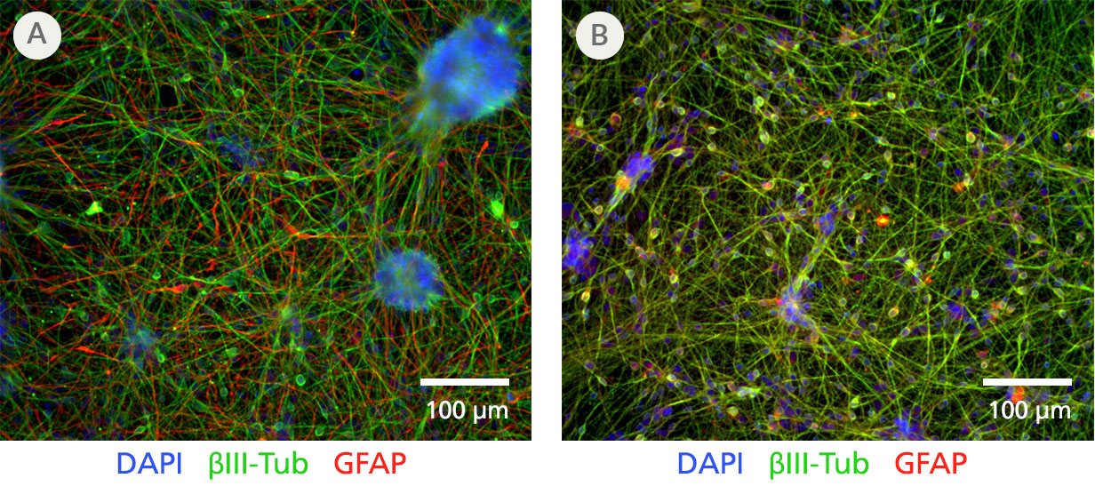 STEMdiff™ Forebrain Neuron Differentiation and Maturation Kits Are Replacing STEMdiff™ Neuron Kits and Have Equivalent Performance in Deriving Forebrain-type Neurons from Neural Progenitor Cells