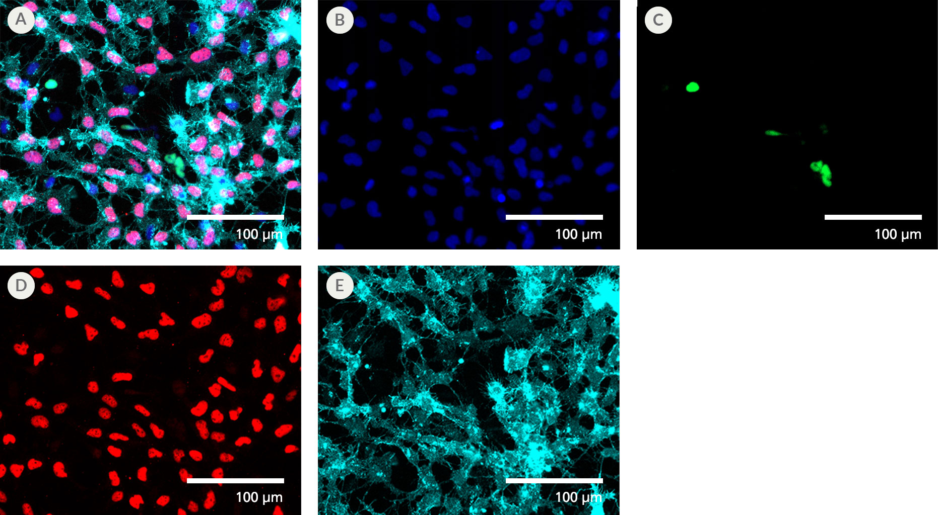 STEMdiff™ Neural Crest Differentiation Kit Generates a Highly Pure Population of NCCs with Minimal CNS-type Progenitors