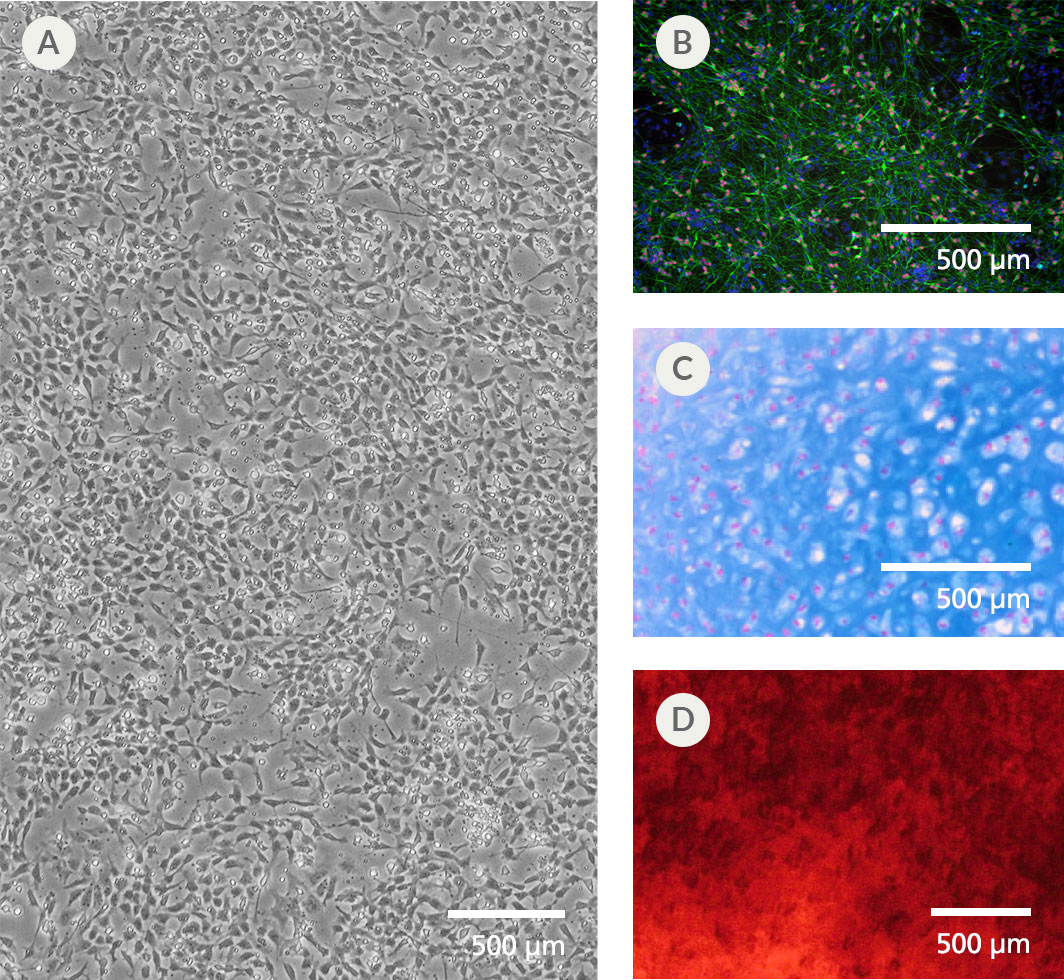 NCCs Generated with the STEMdiff™ Neural Crest Differentiation Kit Are Multipotent