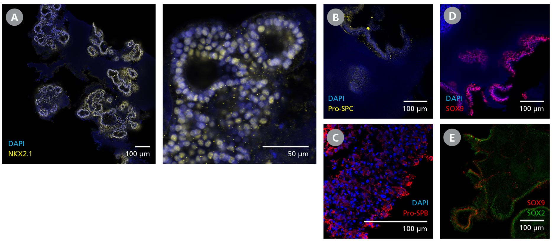 Panel of immunocytochemistry (ICC) images demonstrating the protein expression of key lung markers in branching lung organoids generated using STEMdiff™ Branching Lung Organoid Kit and matured using STEMdiff™ Branching Lung Organoid Maturation Kit.