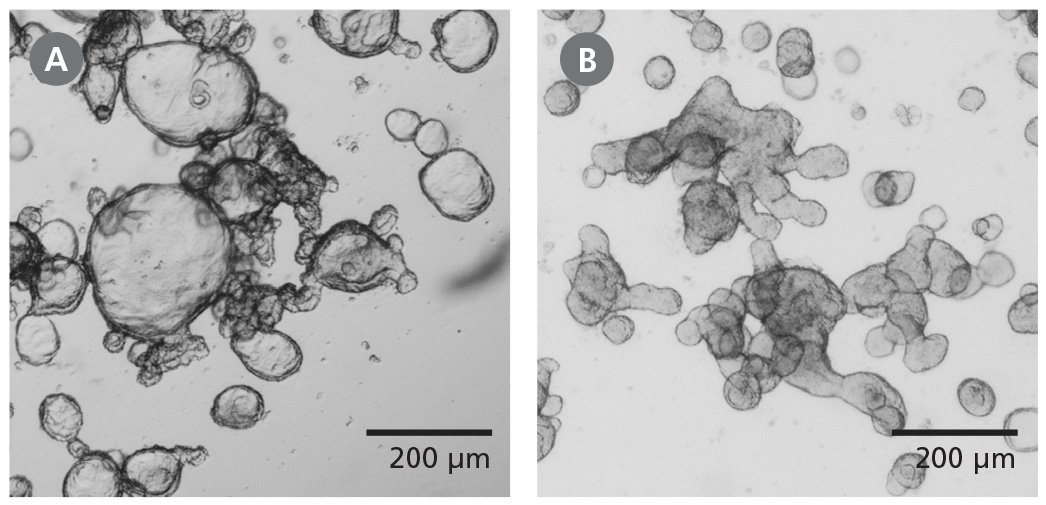 Differentiated Human Intestinal Organoids Display a Budded Morphology