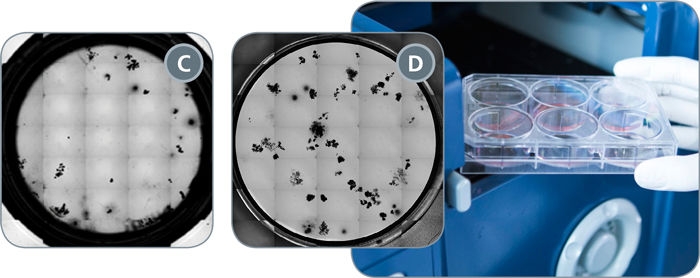 Automated Counting of Hematopoietic CFU Assays